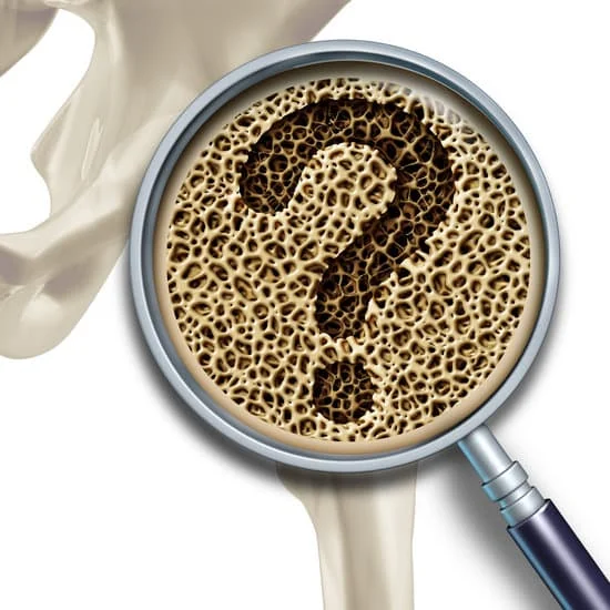 Ayurvedic Treatment For Osteoporosis In India
