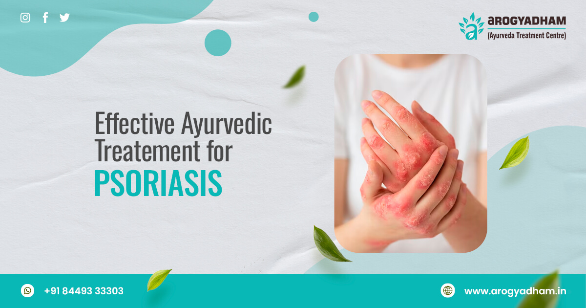 Ayurvedic Treatment For Psoriasis In India