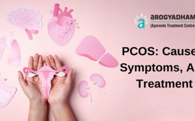 PCOS: Causes, Symptoms, And Treatment